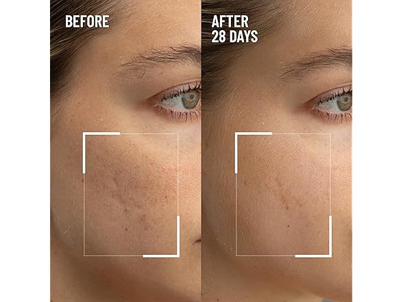 Dr. Brandt Renewing Face Exfoliator