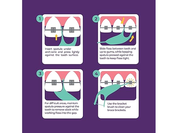 Platypus Orthodontic Flossers for Braces