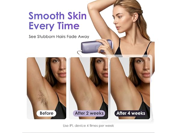 Ipl Laser Hair Removal Device 25J