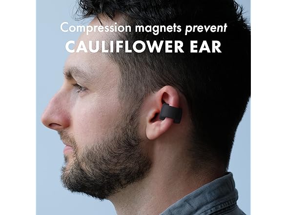 Earies Cauliflower Ear Treatment
