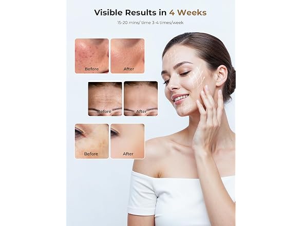 Red Light Therapy Mask