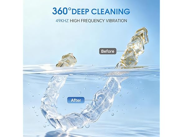 AIJIAXING Ultrasonic Retainer Cleaner - Gallery 4