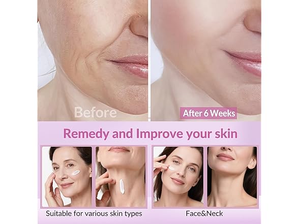 VicGFHS Neck Cream for Firming