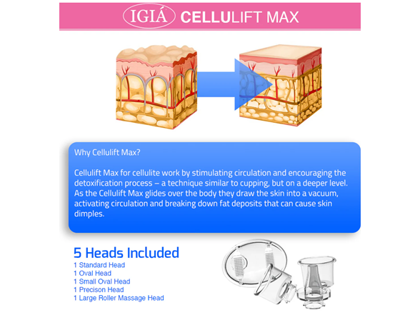 IGIA Cellulift Max Cellulite Reducing Suction