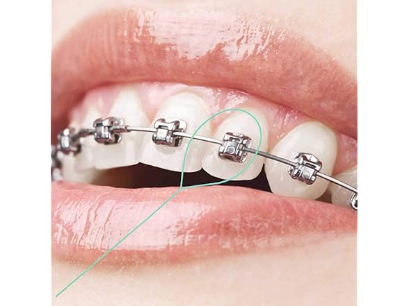 Lit-Pack Floss Threaders for Crown Brace Bridge