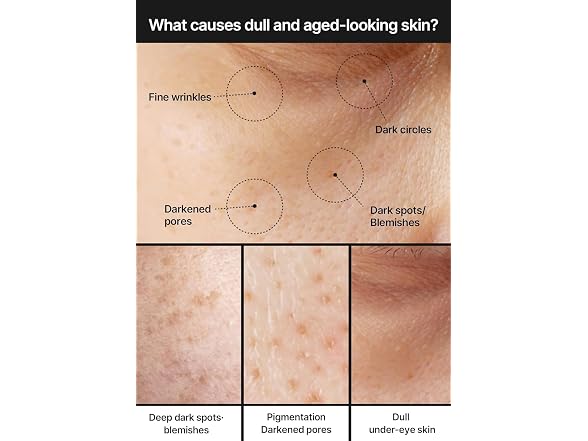 celimax Pore Dark Spot Brightening Cream