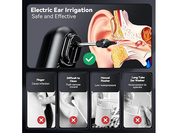 Electric Ear Wax Removal Kit