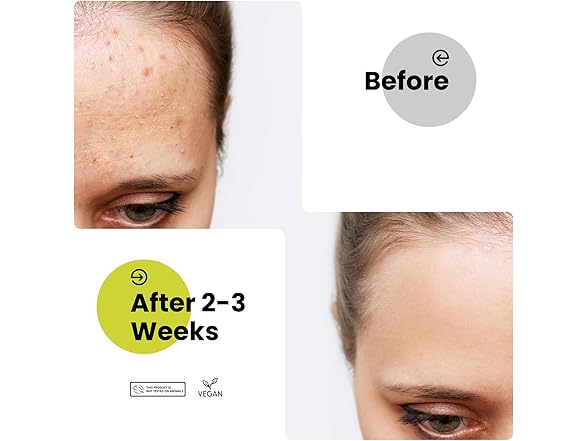 Amifiy Microcrystal Dark Spot Patches